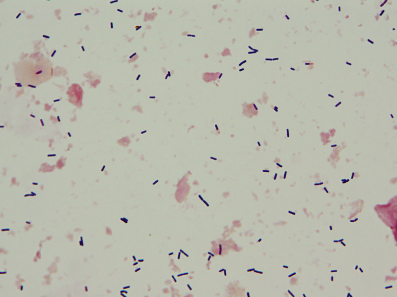 Clostridium Perfringens Virtual Lab Microbiology