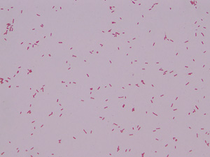 Gram Negative Bacilli - image