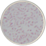 Pleomorphic and Faint Staining Bacilli