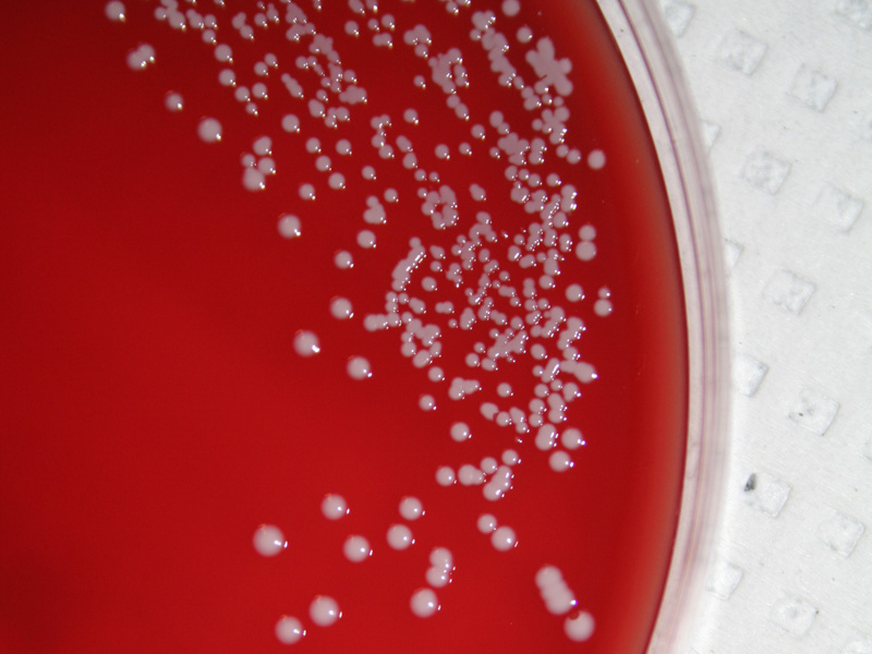 Coagulase Negative Staphylococcus - image