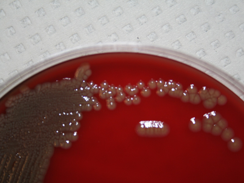 Stenotrophomonas maltophilia - image