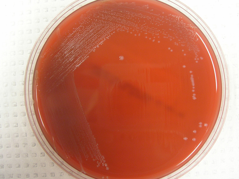 Streptococcus gallolyticus - image