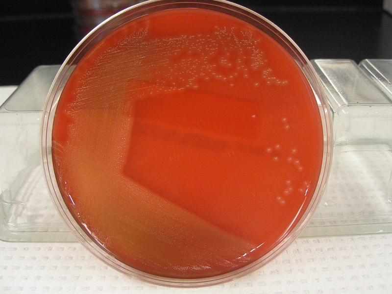 streptococcus-pyogenes-virtual-lab-microbiology