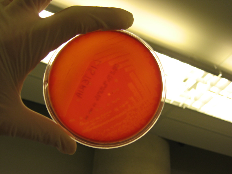 Listeria monocytogenes - image