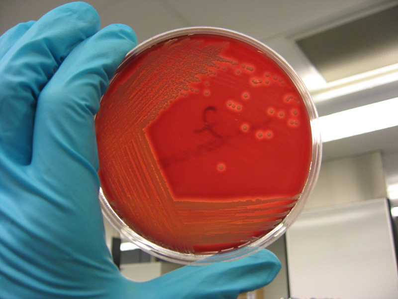 Staphylococcus aureus - image