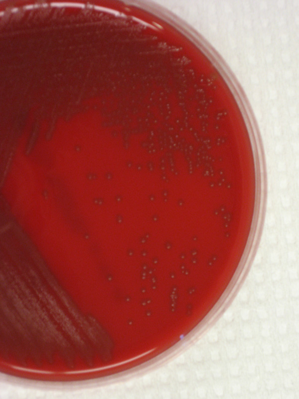 Viridans Streptococcus - image